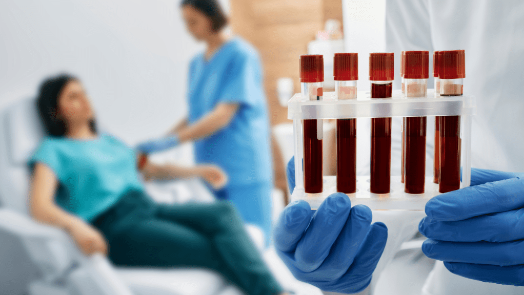 Why You Should Consider Regular Blood Tests with Full Hormone Panels